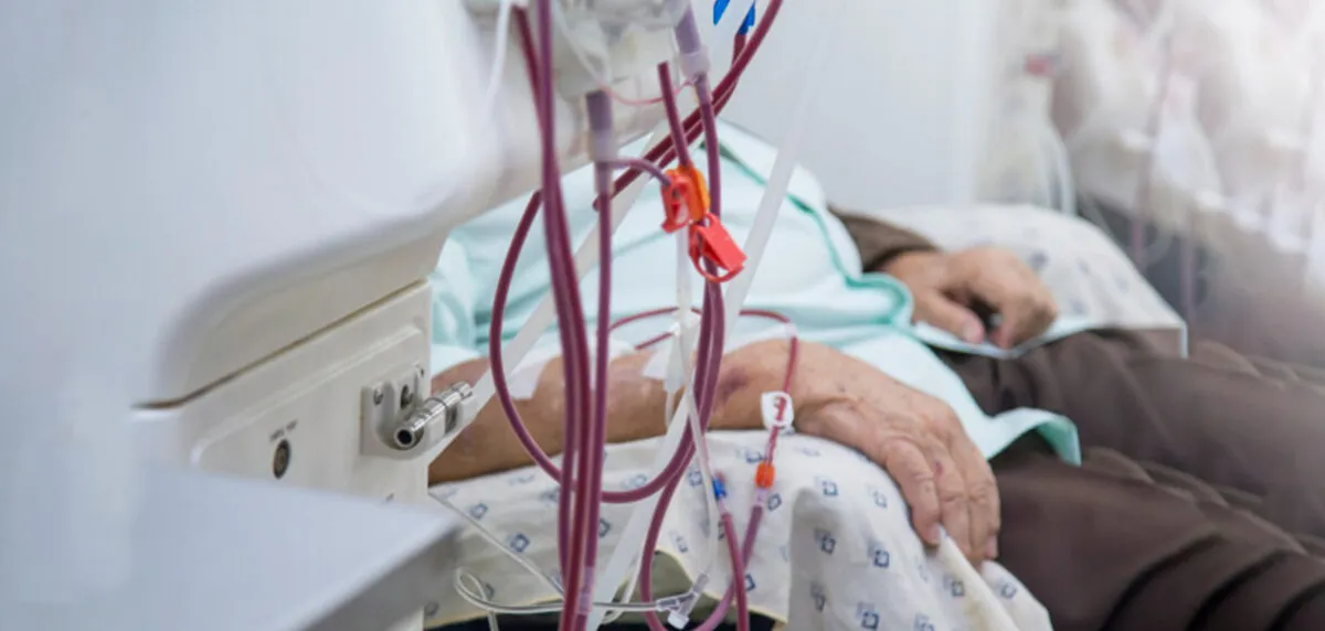 Pacientes que sufren de la enfermedad renal crónica, en el proceso de diálisis.